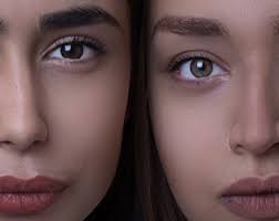 Understanding the Difference Between Rhinoplasty and Septoplasty